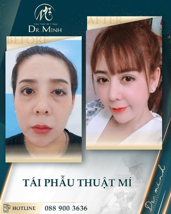 Dr. Minh 1