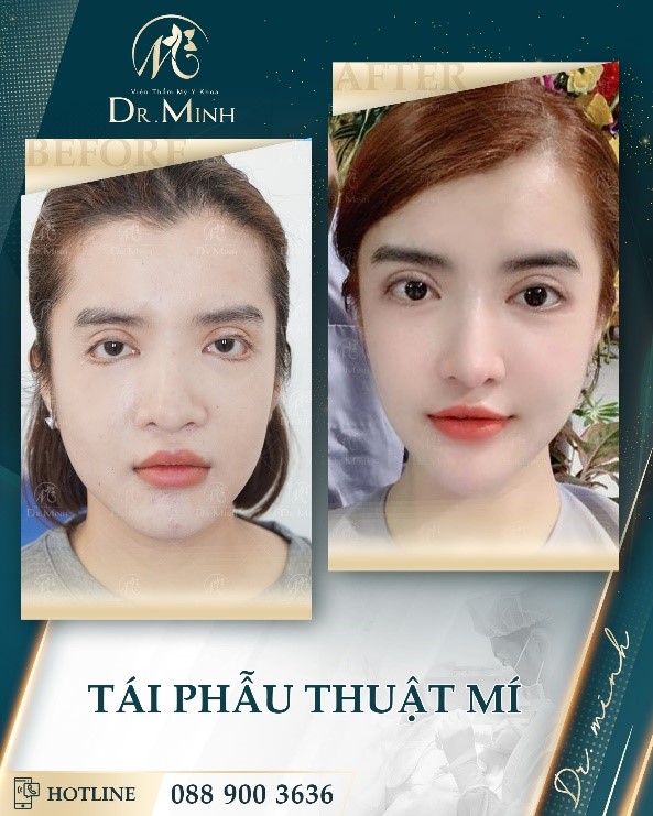Dr. Minh 2