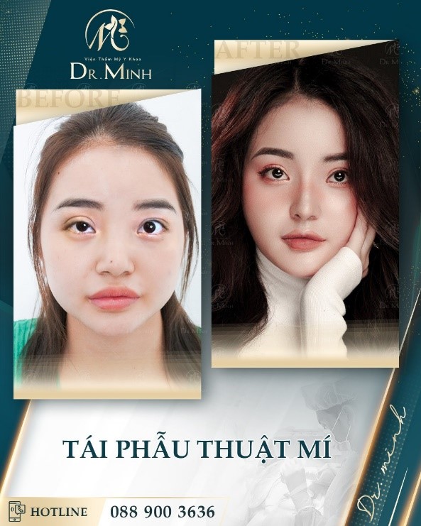 Dr. Minh