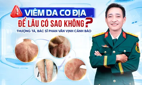 Viêm da cơ địa để lâu có sao không? Thượng tá, bác sĩ Phan Văn Vịnh cảnh báo nguy cơ