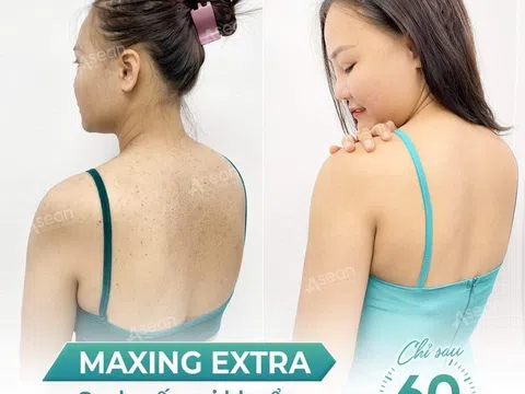 Có nên điều trị viêm nang lông bằng công nghệ Maxing Extra tại Thẩm mỹ Quốc tế Asean không?