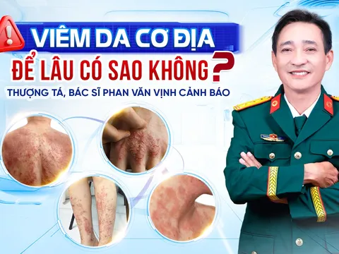 Viêm da cơ địa để lâu có sao không? Thượng tá, bác sĩ Phan Văn Vịnh cảnh báo nguy cơ